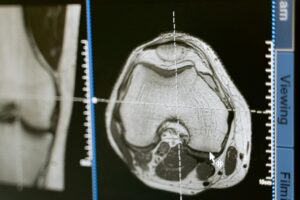 CT, MRI, a może RTG Czym są badania obrazowe i kiedy je stosować?