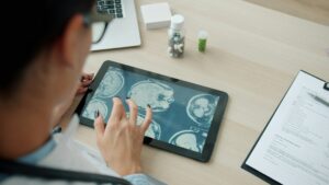 Recepta online na leki neurologiczne – kiedy lekarz może przedłużyć leczenie