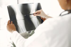 Recepta online na leki reumatologiczne – jak wygląda konsultacja online