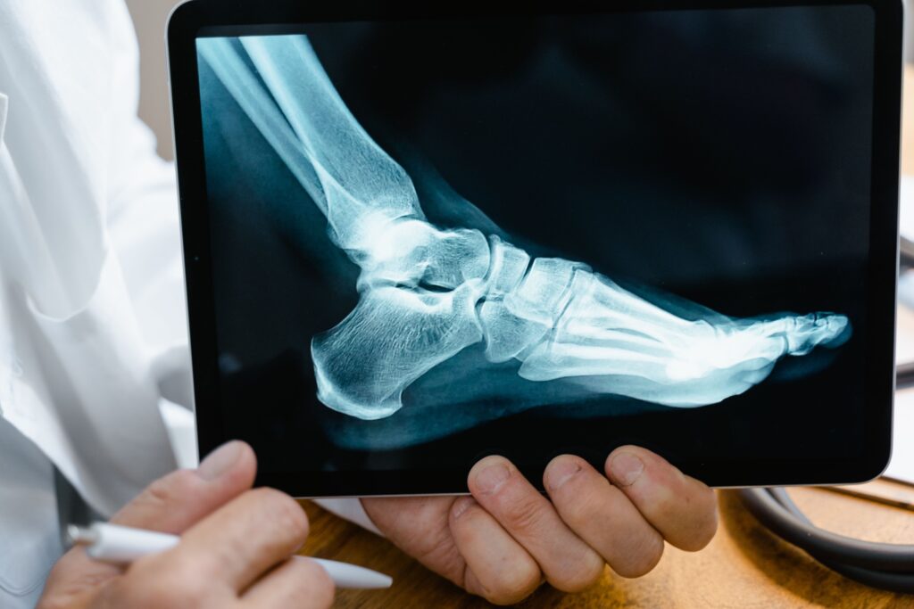 Recepta online na leki reumatologiczne – jak wygląda konsultacja online